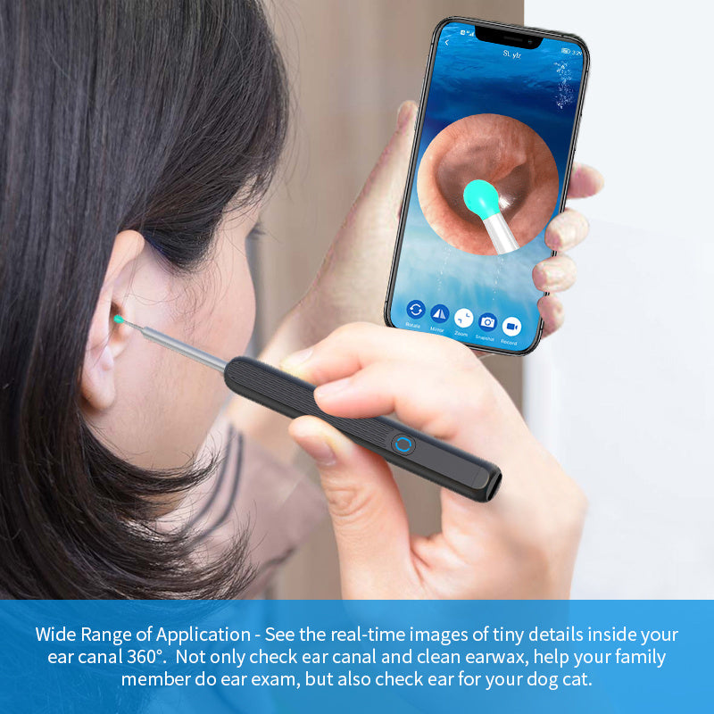 NE3 Wireless Ear Cleaner Otoscope with Camera & LED Light for iPhone
